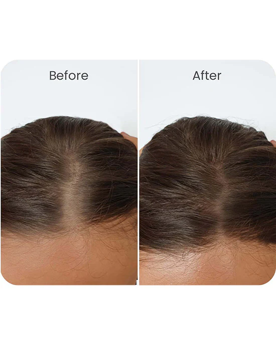 Vital Hair Complex - Image 5