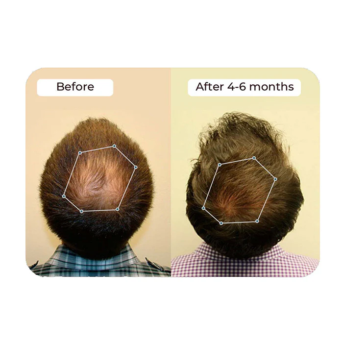 Vital Hair Complex - Image 6