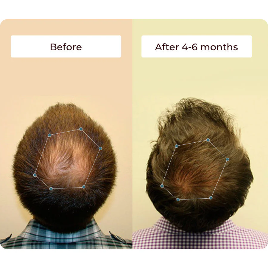 Vital Hair Complex - Image 5