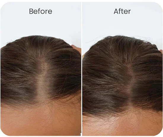 Vital Hair Complex - Image 4