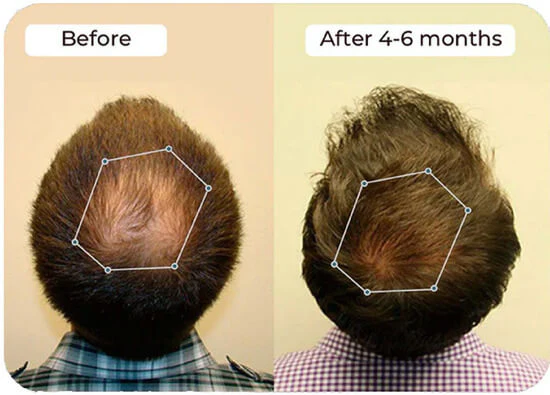 Vital Hair Complex - Image 5