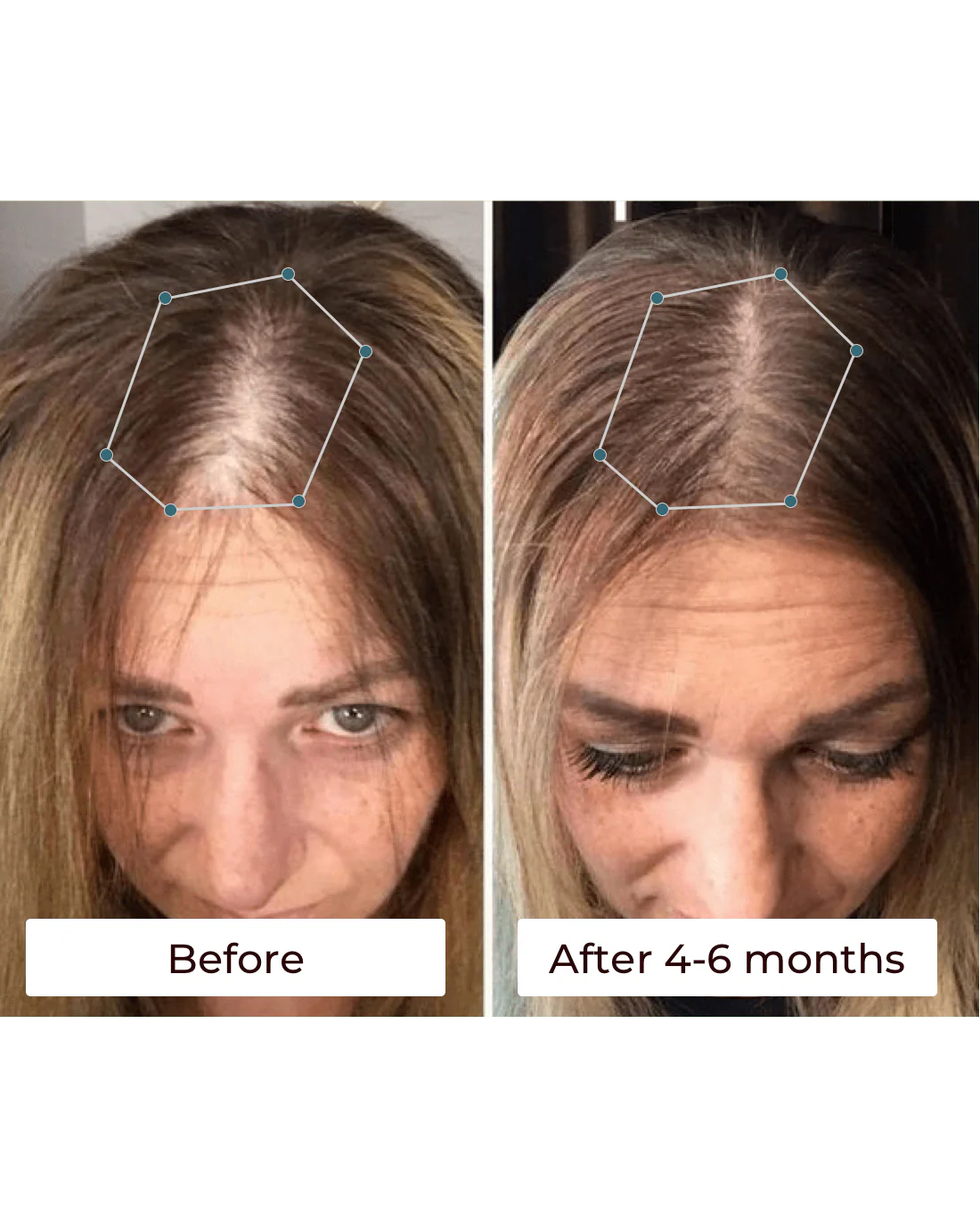 Vital Hair Oil - Image 4